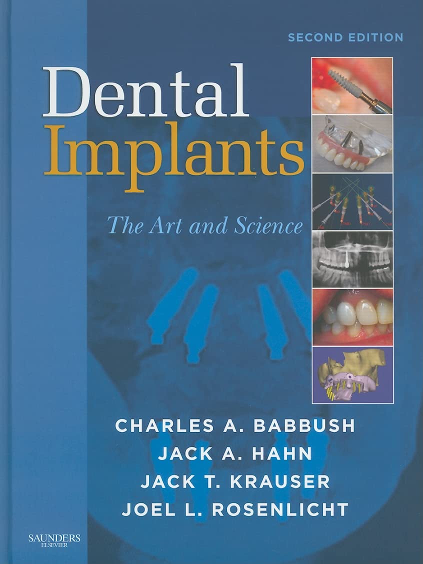 Saunders Dental Implants, The Art And Science 2nd Edition by Charles Babbush Hardcover – Illustrated, 17 March 2010