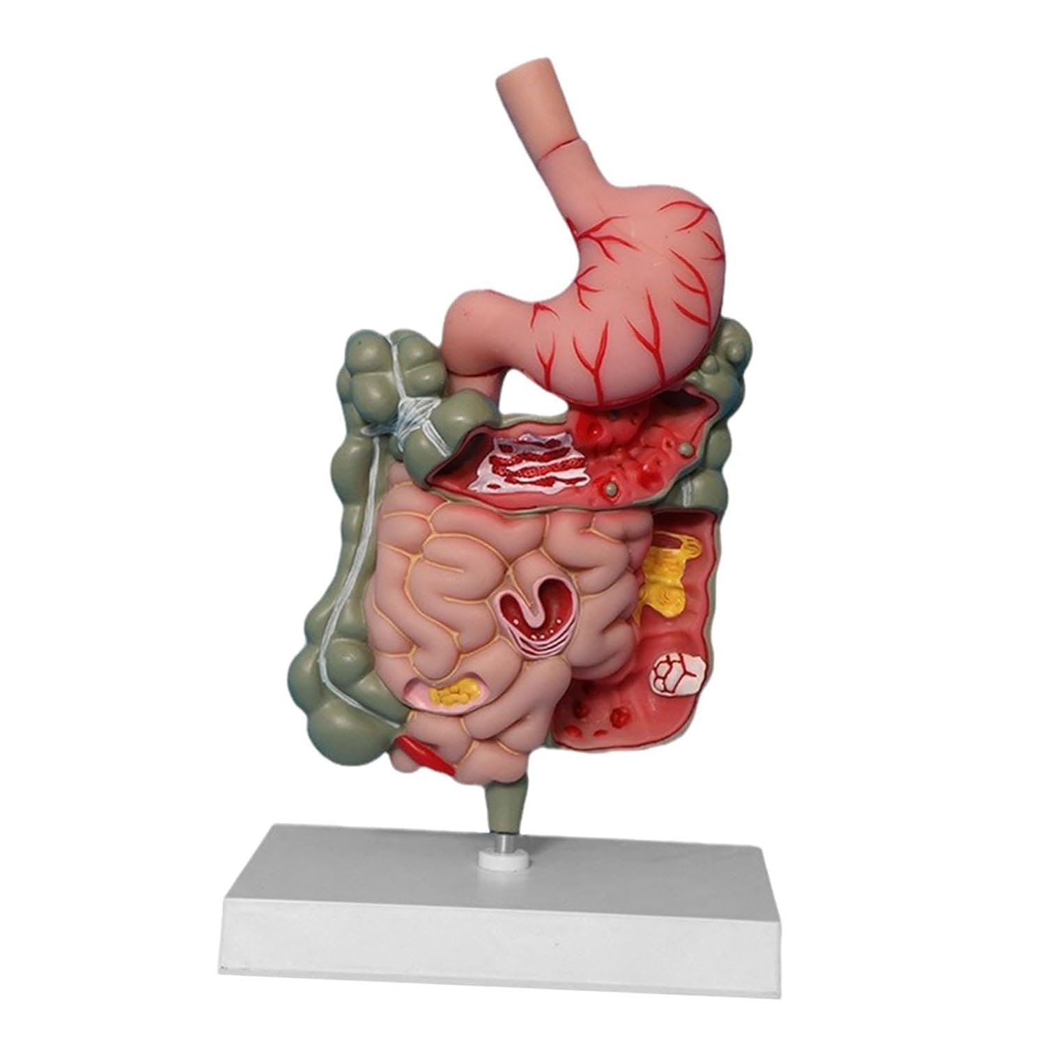 Human Digestive System Model - Stomach Section PVC Anatomy Display with Duodenum Rectum Cecum for Classroom Demonstration