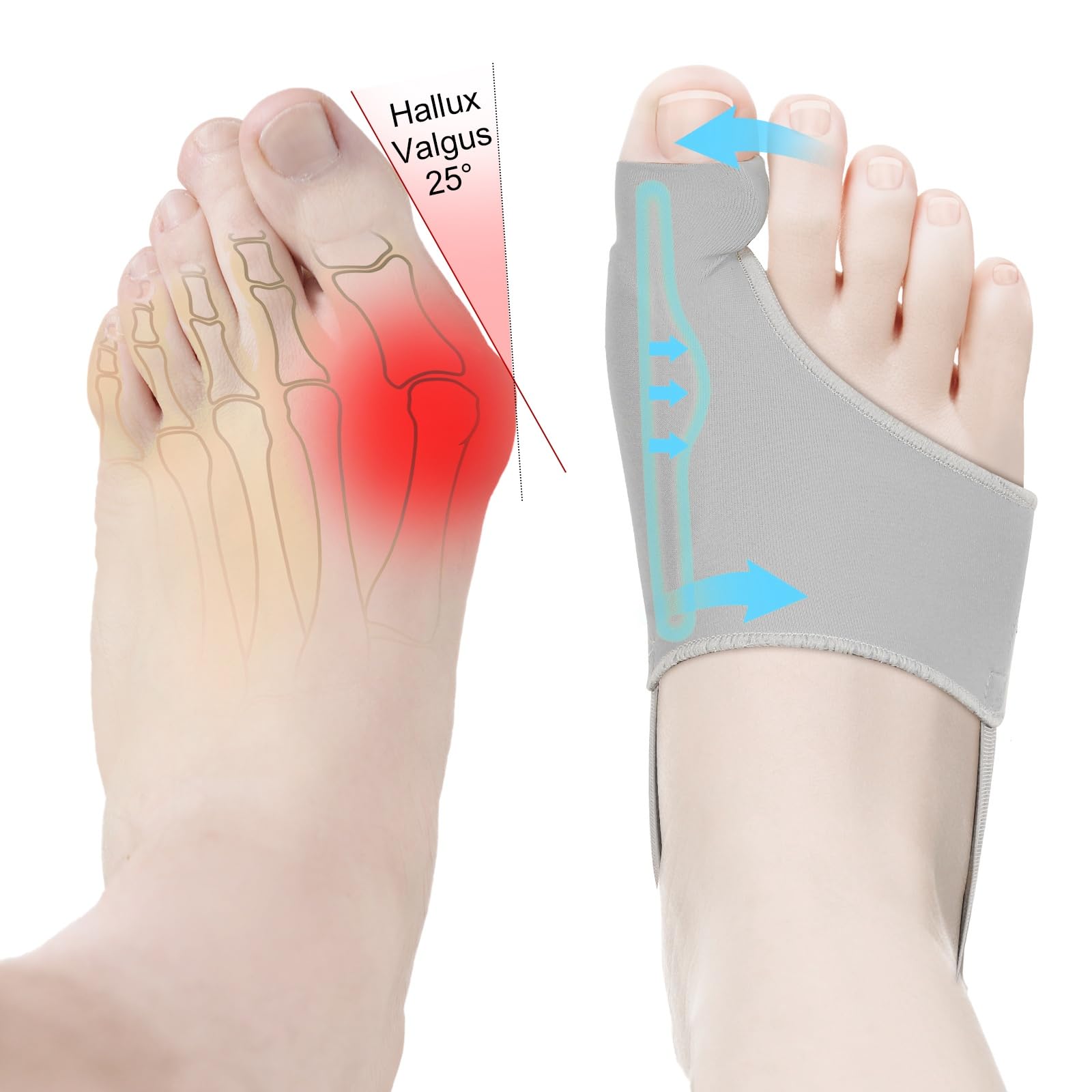 2Pcs Bunion Corrector for Women & Men Big Toe Straightener-Bunions Correction Women & Men-Bunion Splint-Bunion Pads for Bunions Relief-Hallux Valgus Pain Relief,Comfortable & Breathable for Day/Night