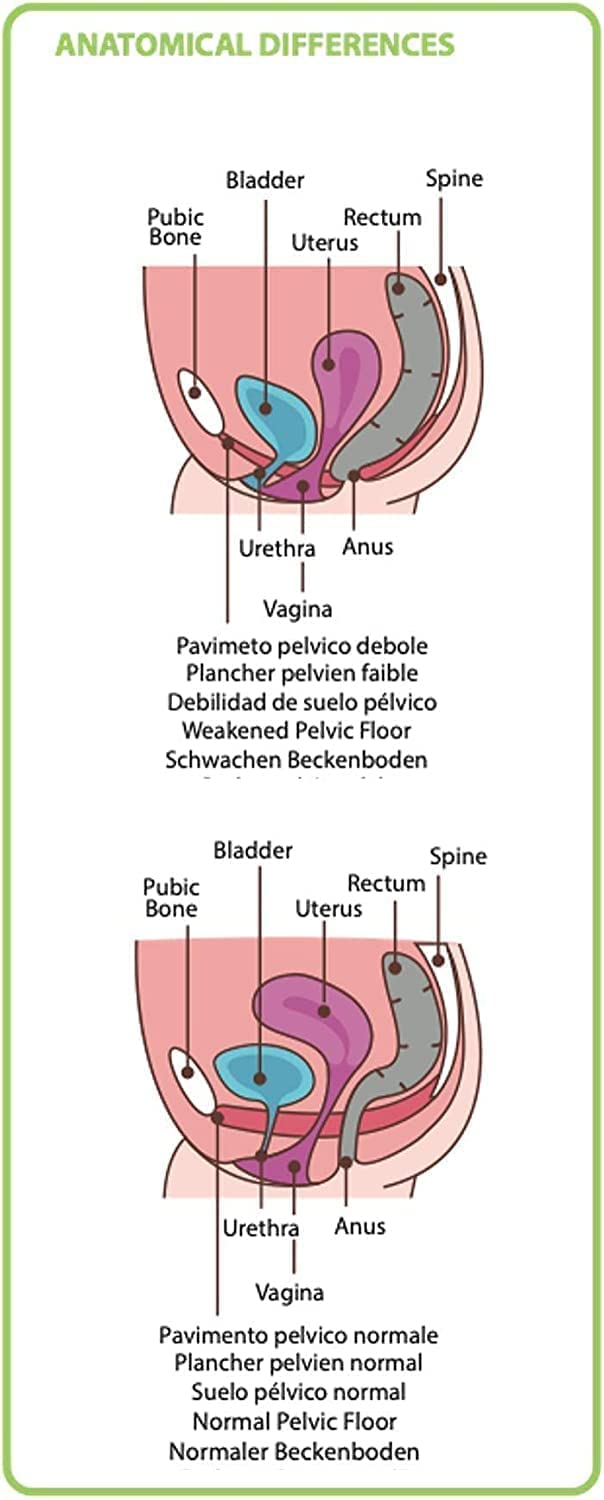 3 Coni Palline Kegēl - Dispositivo Medico Brevettato per la Riabilitazione del Pavimento Pelvico - Ginnastica Pelvica per Incontinenza Urinaria, per Post Parto