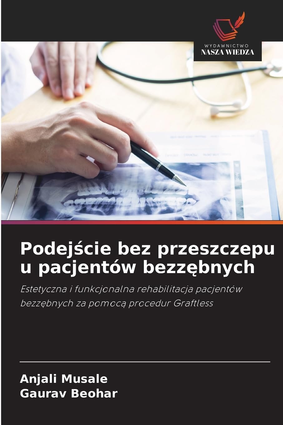 Podejście bez przeszczepu u pacjentów bezzębnych: Estetyczna i funkcjonalna rehabilitacja pacjentów bezz¿bnych za pomoc¿ procedur Graftless