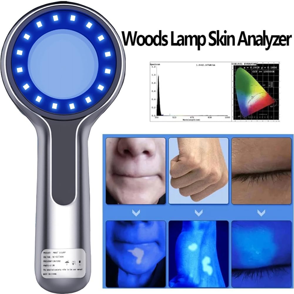 Lampe Woods Analyseur de Peau UV Grossissant pour les Tests de Beauté Du Lampe Wood pour les Tests D'Analyse des Soins de la Peau