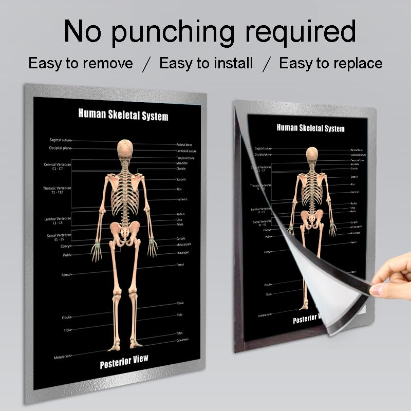 Image of Taanfu Body Educational Learning Posters - Skeletal & Digestive System Anatomy Art, Small Intestine & Villi Wall Art