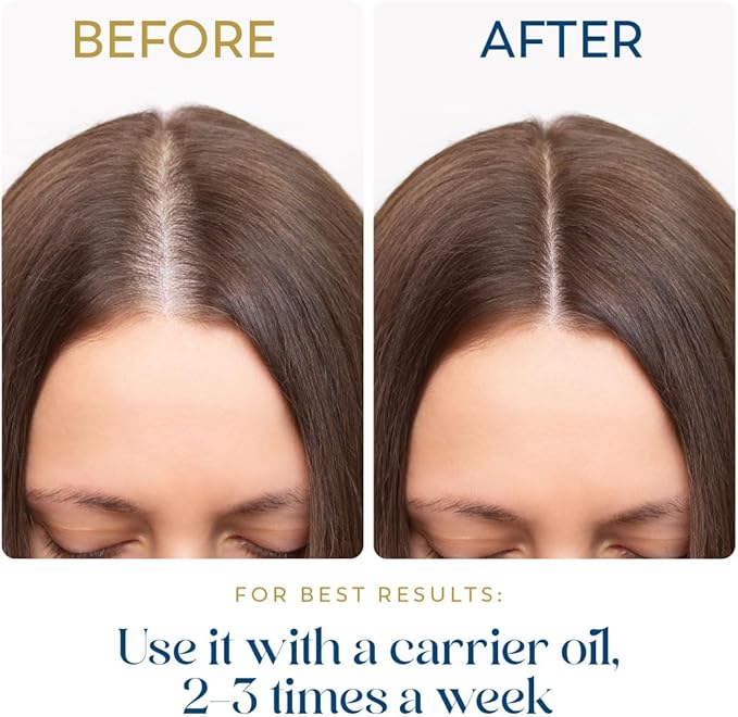 Aceite Esencial de Romero para Cabello - 3.3 fl oz - Puro miniatura 7