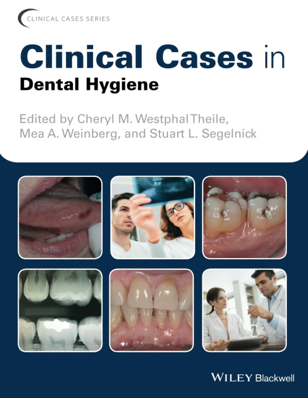 語学+参考書 Periodontics (2) (Dental clinical series basic) Periodontics (2) (Dental clinical series basic) | 北川原 健