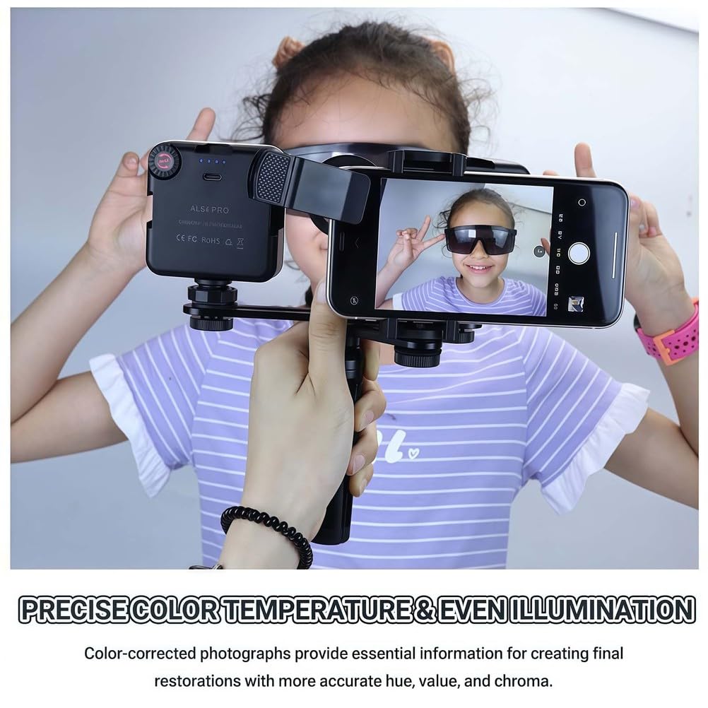 Dental Photography Aid - Supplemento luminoso di riempimento per fotocamere cellulari, ideale per cosmetologia e fotografia macro di prodotti