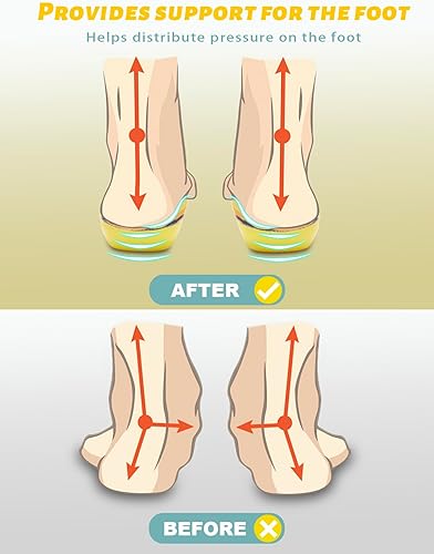 Miniatura 3 de Plantillas ortopédicas para hombres y mujeres, insertos de soporte de arco de alta calidad para pies planos, fascitis plantar, alivio del dolor en
