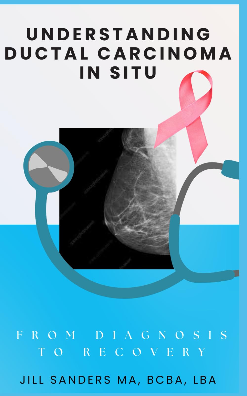 Understanding Ductal Carcinoma in Situ: From Diagnosis to Recovery