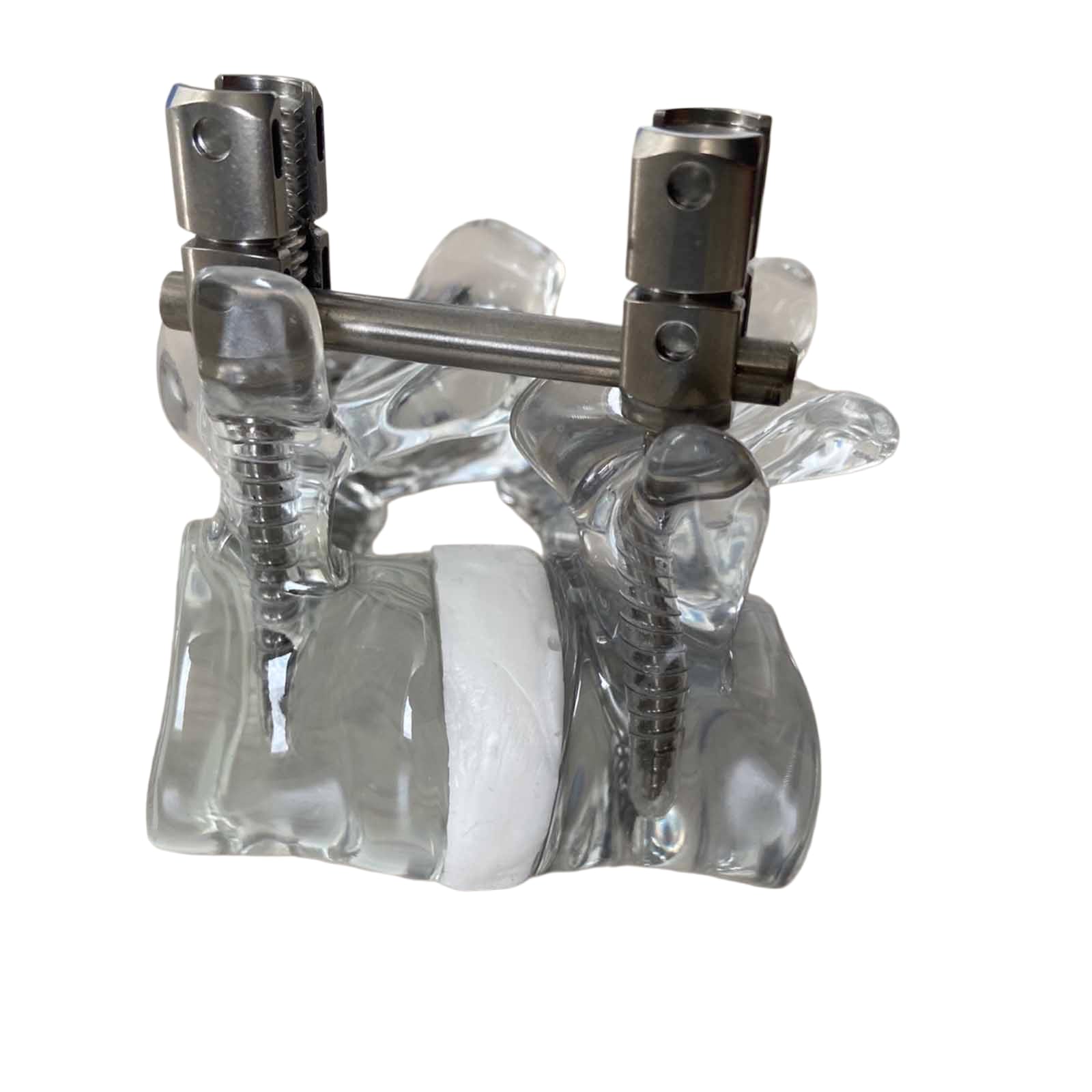YRQMGSF Lumbar Internal Fixation Model Transparent Lumbar Spine Model for Veterinarian's Offices and Classrooms