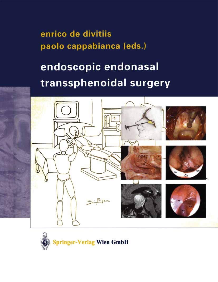 Endoscopic Endonasal Transsphenoidal Surgery (English Edition)