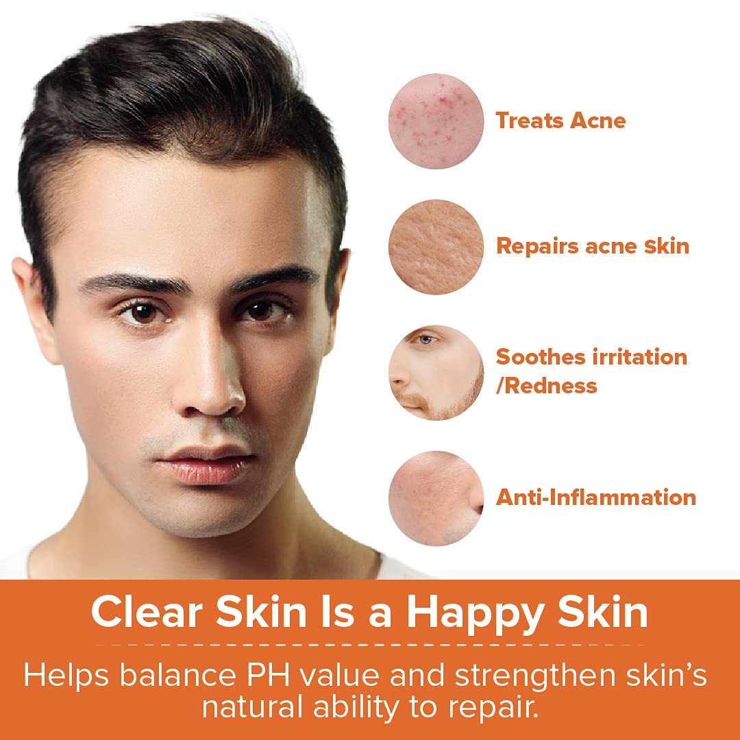 Buy mars by GHC Skin Correct Gel, Anti Acne Gel (30 g Pack of 1