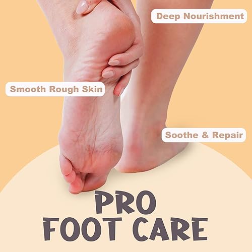 Miniatura 6 de Crema de urea 40 por ciento para talones y pies secos y agrietados con aceite de coco y vainilla planifolia, removedor de callos y suavizante de