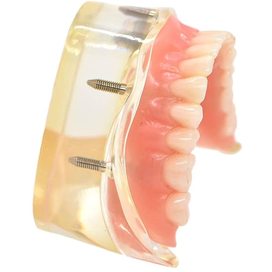 総入れ歯　歯科　入れ歯　フルデンチャー　模型　上顎　下顎　洗ってみました 総入れ歯 歯科 入れ歯 フルデンチャー 模型 上顎 下顎 洗ってみ