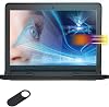 MUBUY-GOL Screen Protector for 11.6 Dell Chromebook 11 & Dell Chromebook 11 3100 3120 3180 3181 3189 5190, Anti Blue Light Anti Glare Reduce Eyes Strain Help Sleep Better
