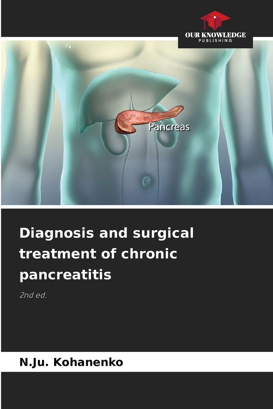 Diagnosis and surgical treatment of chronic pancreatitis: 2nd ed.