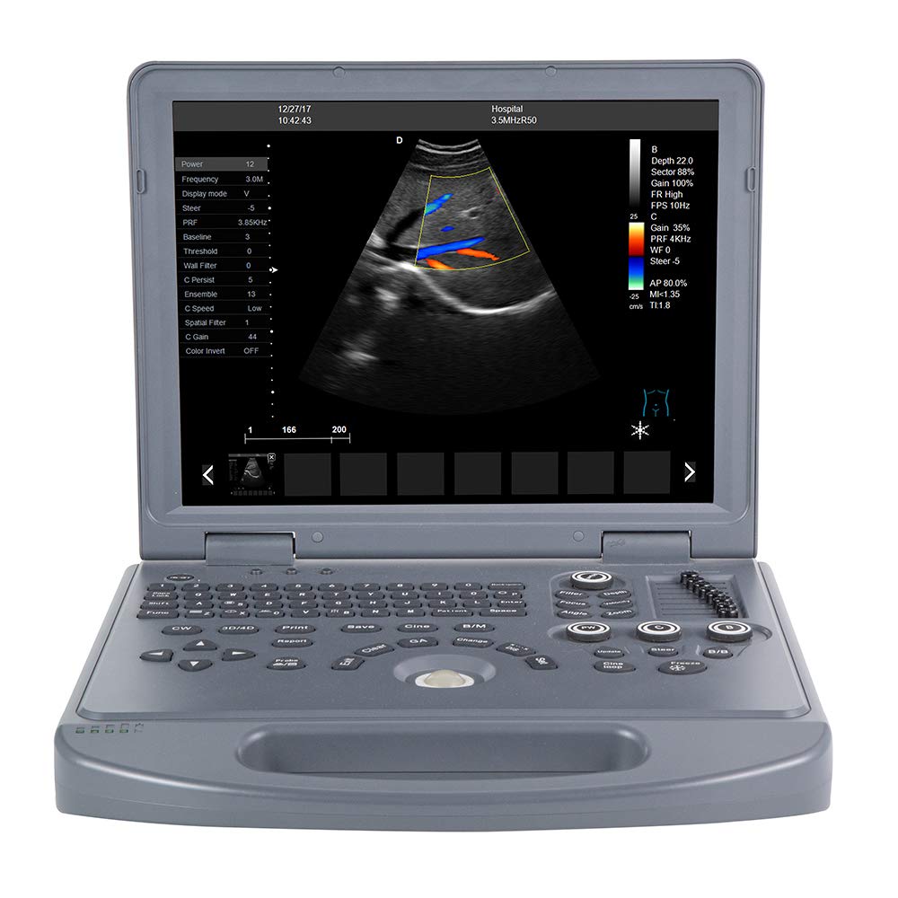 Portable Laptop Ul-tra Sound Scanner 15 inch LED Screen Color E-cho Scanner Machine
