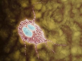 Posterazzi Microscopic view of Giardiasis an infectious disease caused Poster Print by a unicellular parasite known as Giardia lamblia, (16 x 12)