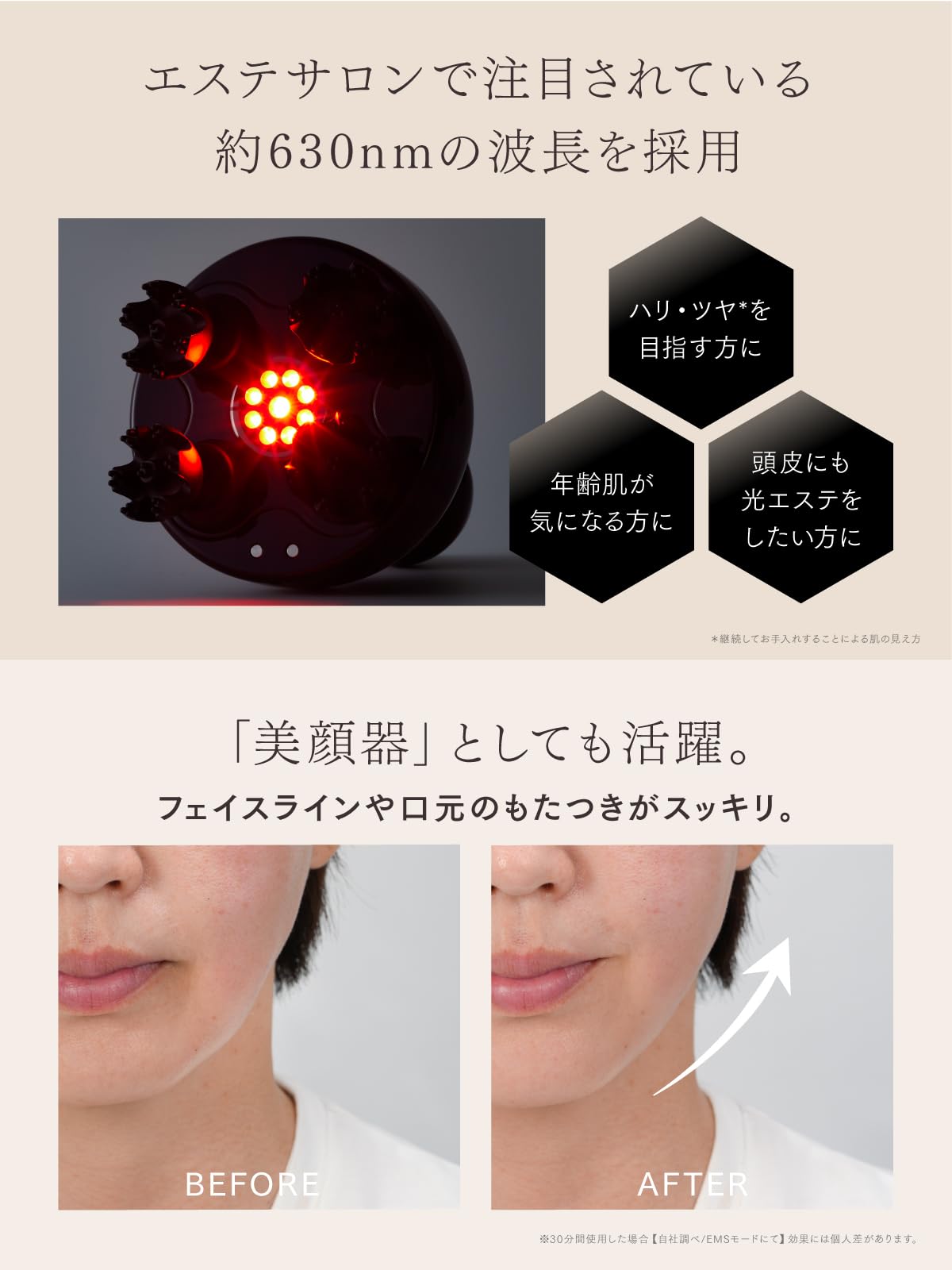 Amazon | 【LDK A評価獲得】MYTREX マイトレックス EMS HEAD SPA DEEP