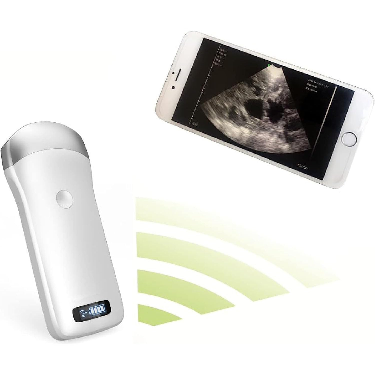 Amazon.co.jp: ポータブルワイヤレス超音波スキャナー、電子凸型振動