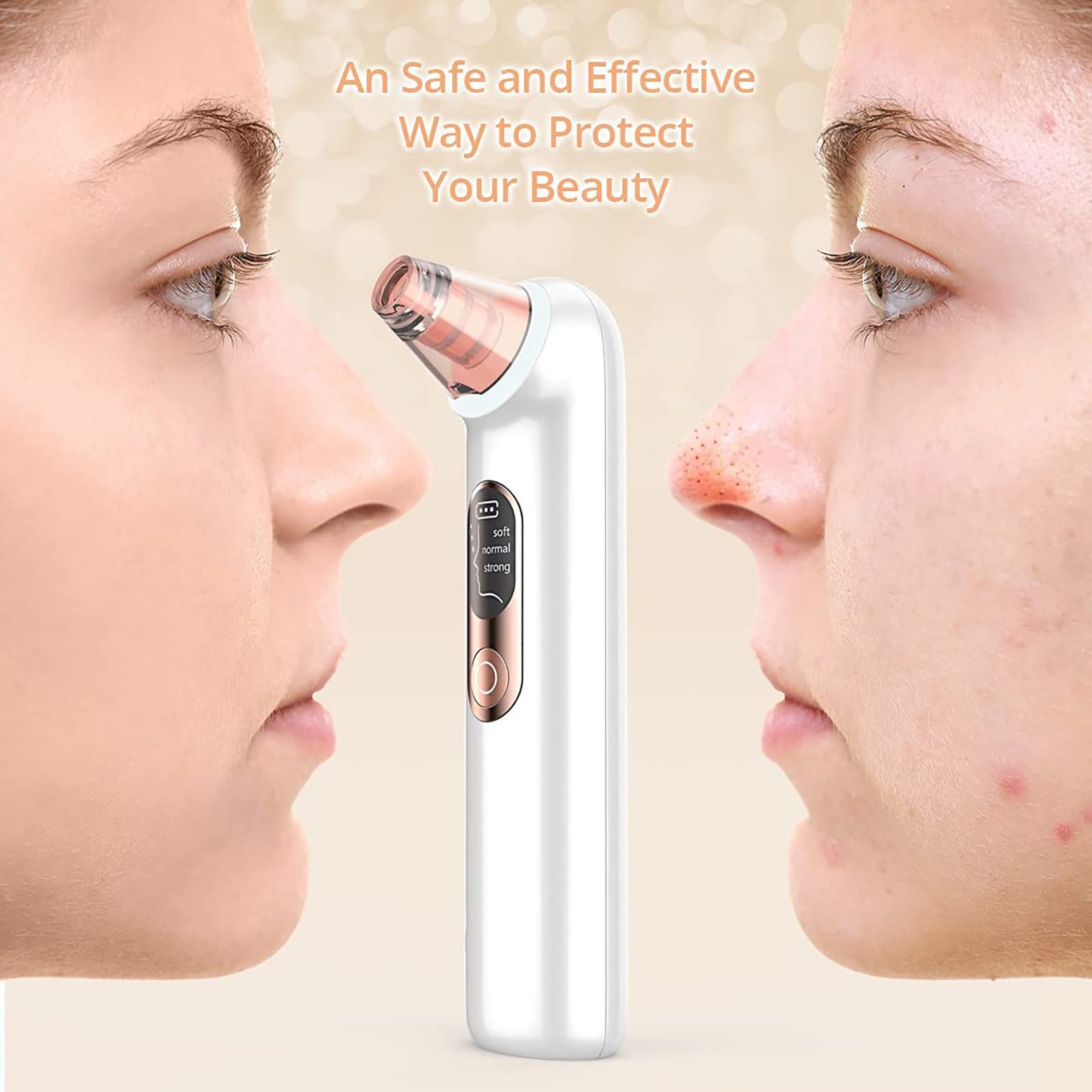 Aspirador de poros para eliminar puntos negros, herramienta extractora de puntos blancos, limpiador eléctrico de poros facial, limpiador de poros facial, herramienta de succión de puntos negros,