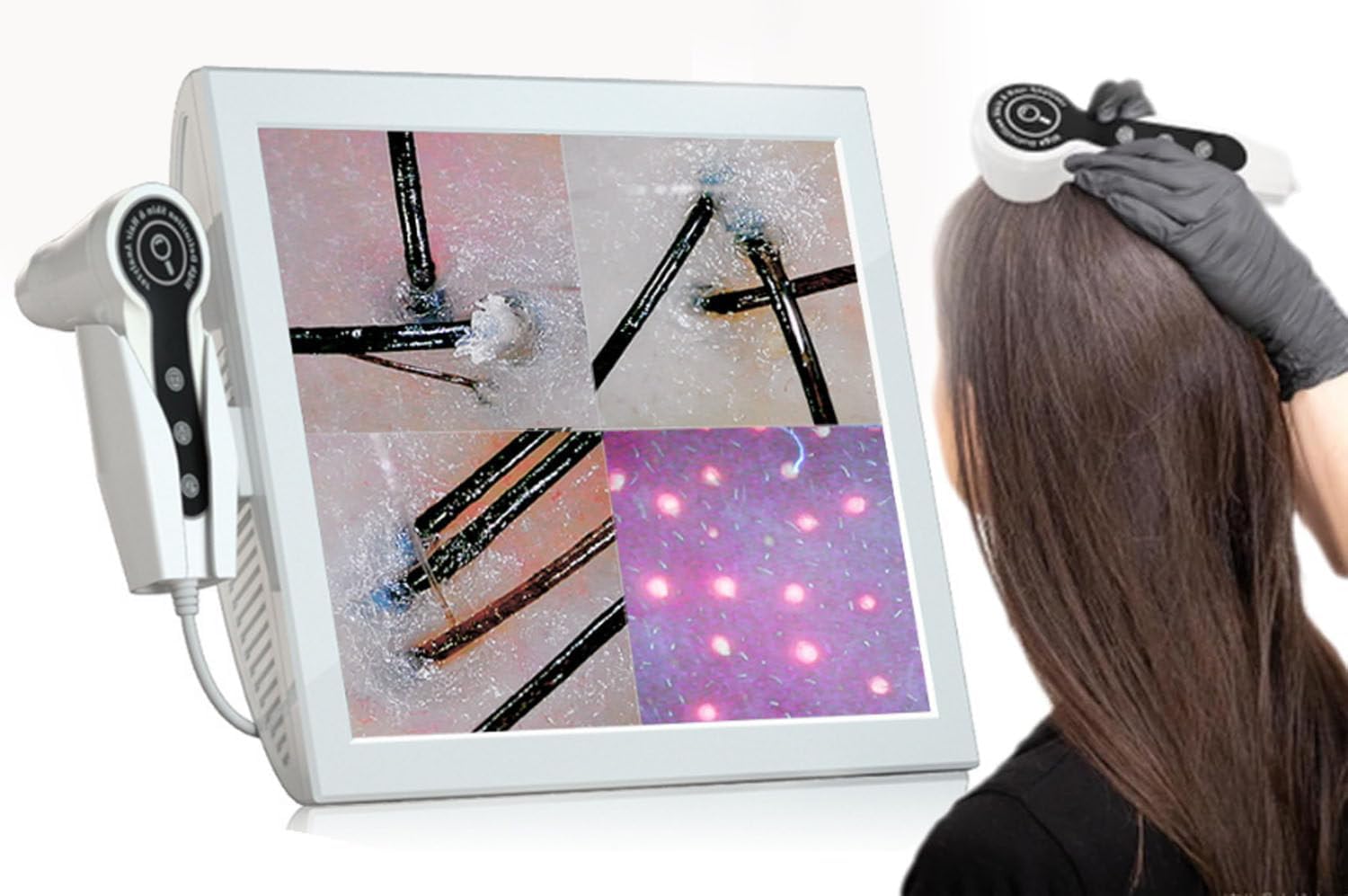 Scalp Hair Follicle Detector, Skin Diagnosis Hair Analyzer,15 Inch 50X 200X Lens Charging Type Scalp Hair Follicle Skin Hair Detector Analyser Machine