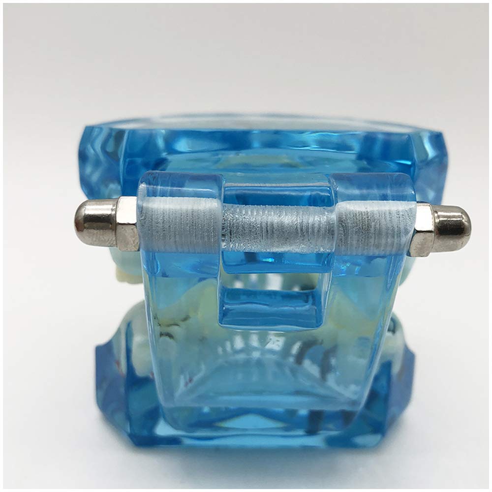 Modello di Denti da 2 Pezzi, Modello di Analisi di Studio di Impianti Dentali per Riparazione di Carie Dentale, Modello Dimostrativo per L'Insegnamento Medico, Forniture di Laboratorio