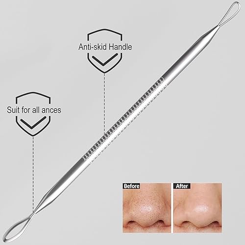 Miniatura 3 de Herramientas para eliminar puntos negros kit de herramientas para picapuñalar paquete de 6 comedones profesionales extractor de acné para manchas
