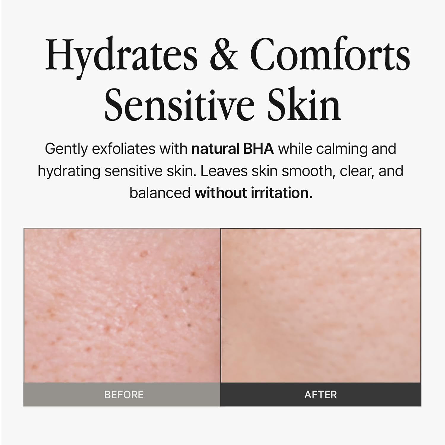 Skin 320ml - Image 3