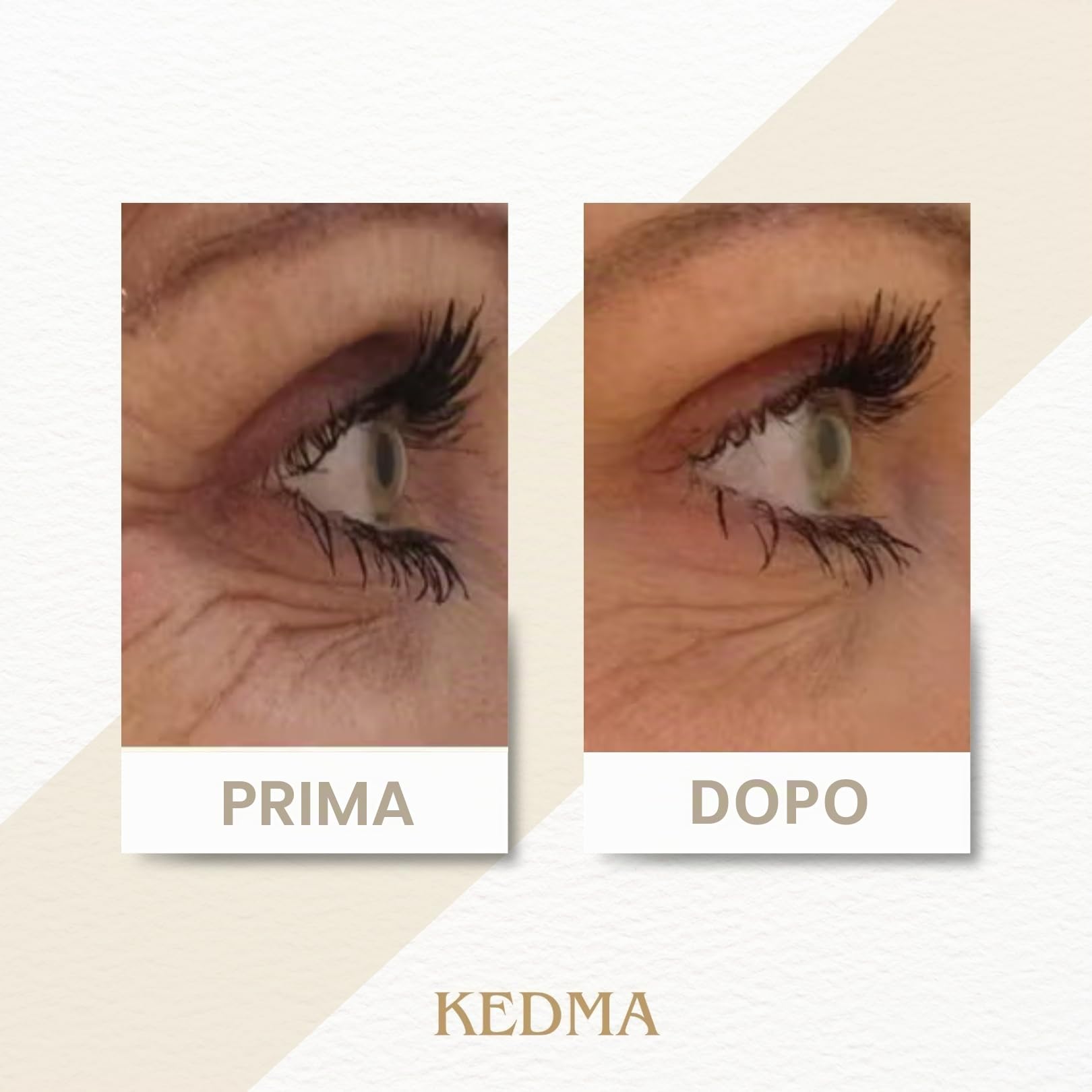 KEDMA - Crema Occhi Anti-Età al Collagene e Minerali del Mar Morto - 50g | La crema occhi al collagene idrata il contorno occhi e aiuta ad attenuare borse e linee sottili.