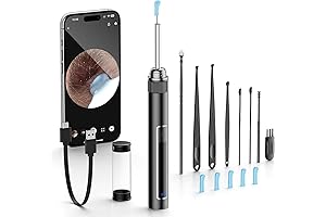 Lighted HD Ear Wax Removal Tool with 1296P Camera for Easy Ear Cleaning