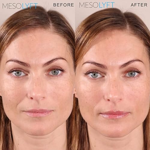 Miniatura 5 de Rellenador de labios con rodillo para rellenar los labios al instante, promueve la hidratación y la plenitud, brillo de labios voluminoso para