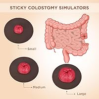 Vista 2 de Simuladores de colostomía pegajosa, juego de modelos de entrenamiento de estoma, modelos de práctica de cuidado de ostomía de varios tonos de piel