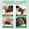W3W Hair Growth Serum for Scalp - Hair Serum for Hair Growth Accelerates, Strengthens & Thickens Hair Nourishing Formula with Caffeine Non-Greasy Hair Regrowth Treatment Prevents Hair Loss & Thinning