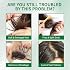 W3W Hair Growth Serum for Scalp - Hair Serum for Hair Growth Accelerates, Strengthens & Thickens Hair Nourishing Formula with Caffeine Non-Greasy Hair Regrowth Treatment Prevents Hair Loss & Thinning