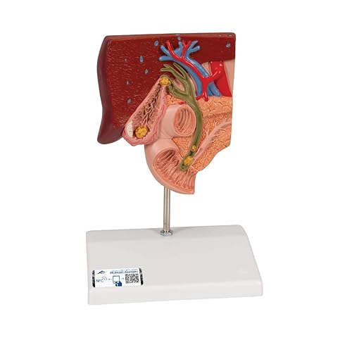3B Scientific Modelo de cálculos biliares K26 - 3B Smart Anatomy