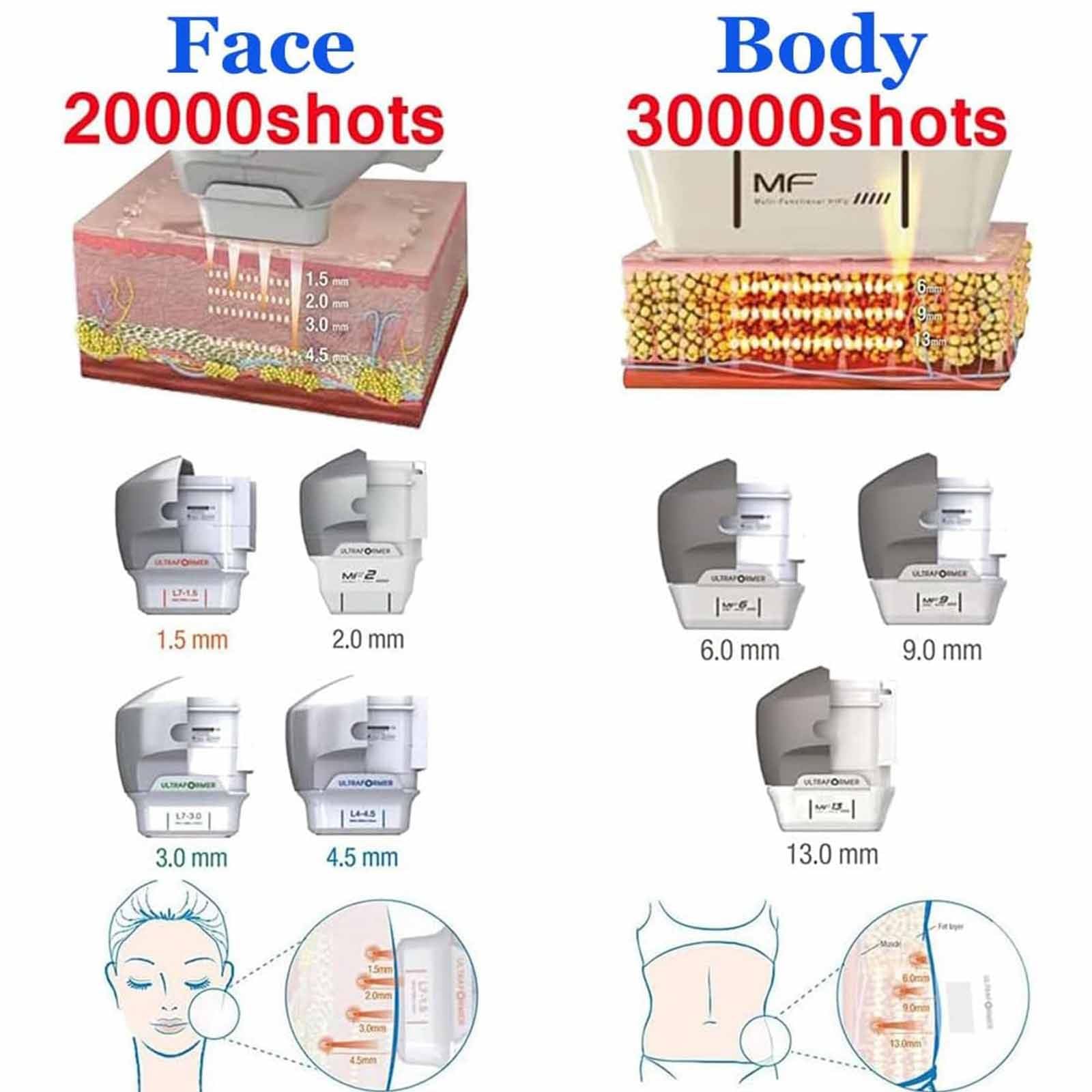 Macchinario Estetico Multifunzione HIFU Schermo HD 15",Rimozione Rughe,Lifting Facciale,Macchina Dimagrante,Trattamenti Viso Corpo in 30 Minuti Risultati Visibili Subito