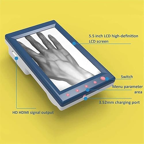 Miniatura 5 de Localizador de Venas Infrarrojo Buscador de Venas para Adultos y Bebés, Detector de Iluminación de Venas, Visualización de Proyección de Luz de