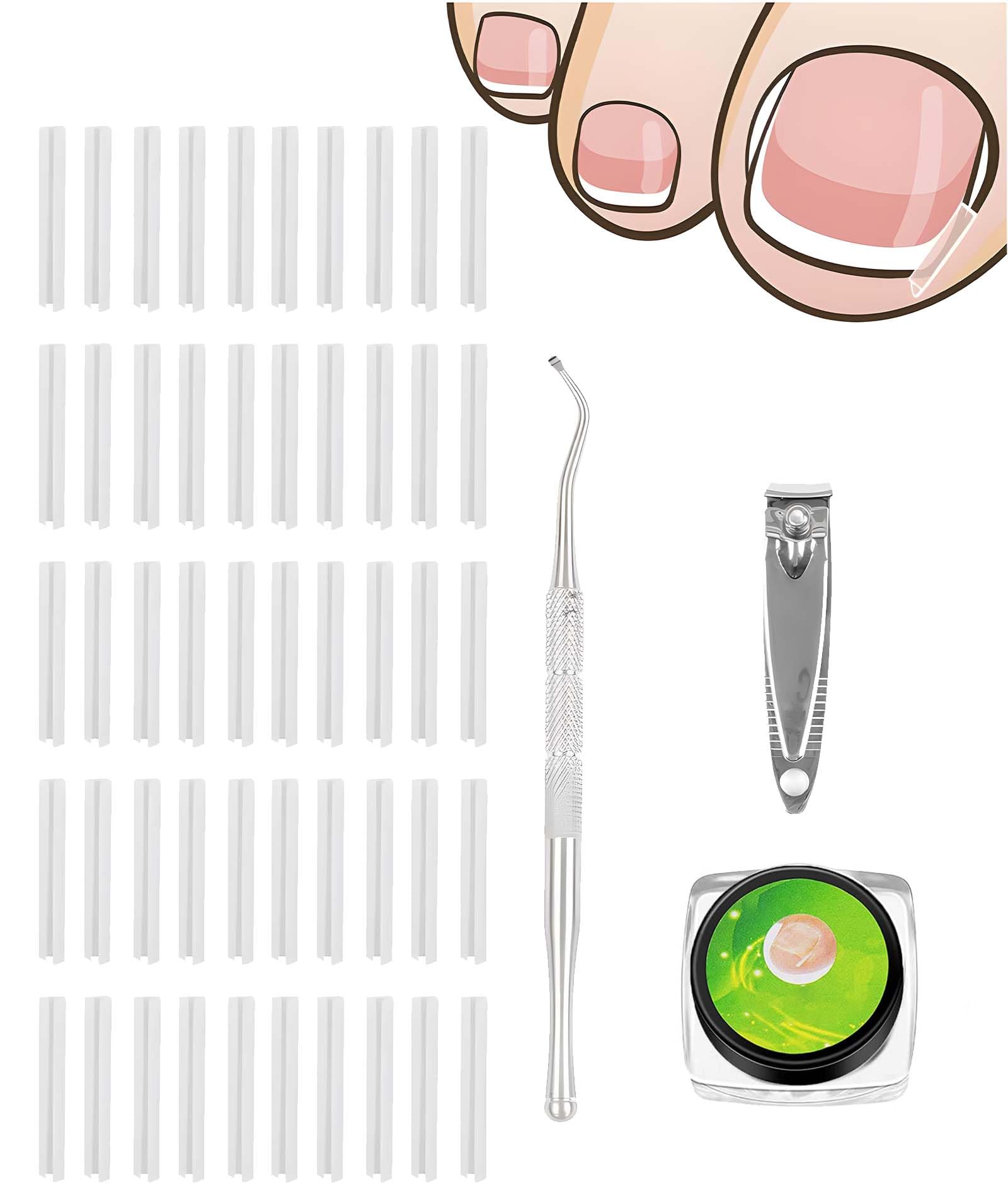 50 PCS Ingrown Toe Nail Remover, Toe Nail Corrector Kit, Ingrown Toenail Correction Tool for Home Foot Care, Includes Nail Clippers and Corrective Tools for Daily Nail Maintenance(Style 1)
