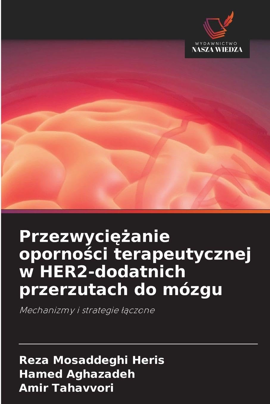 Przezwyci¿¿anie oporno¿ci terapeutycznej w HER2-dodatnich przerzutach do mózgu: Mechanizmy i strategie ¿¿czone