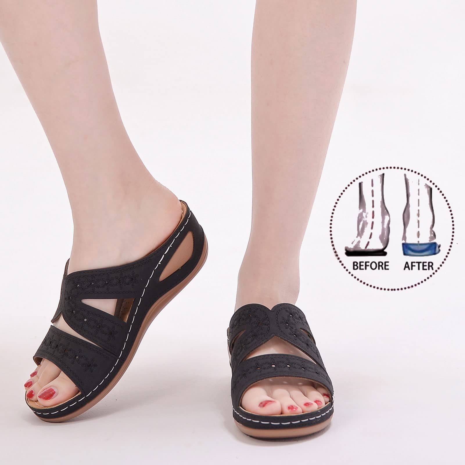 Dames Orthopedische Sandalen, Zomer Dames Sandalen voor Eeltknobbels Comfortabele Wedge Platform Sandalen Clip Toe Platte Strand Wandelschoenen Corrector Flip Flop,Blue,43
