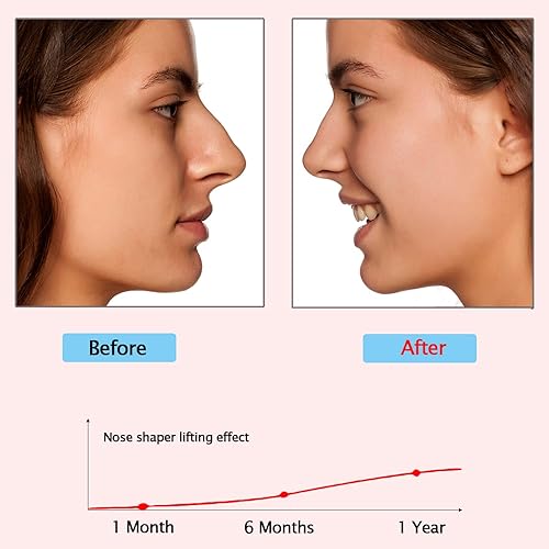 Miniatura 5 de Clip moldeador de nariz, alisador de nariz para narices anchas, embellecedor de nariz de silicona de seguridad, elevador de altura de nariz más