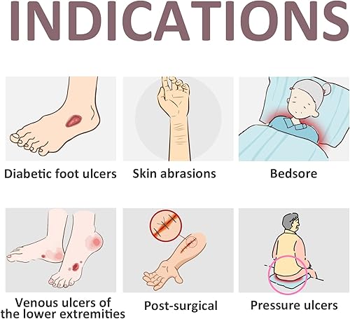 Miniatura 5 de Apósito de alginato de calcio plateado, paquete individual de 4 x 4 pulgadas, 6 unidades, altamente absorbente, no adhesivo, sin dolor, eliminación