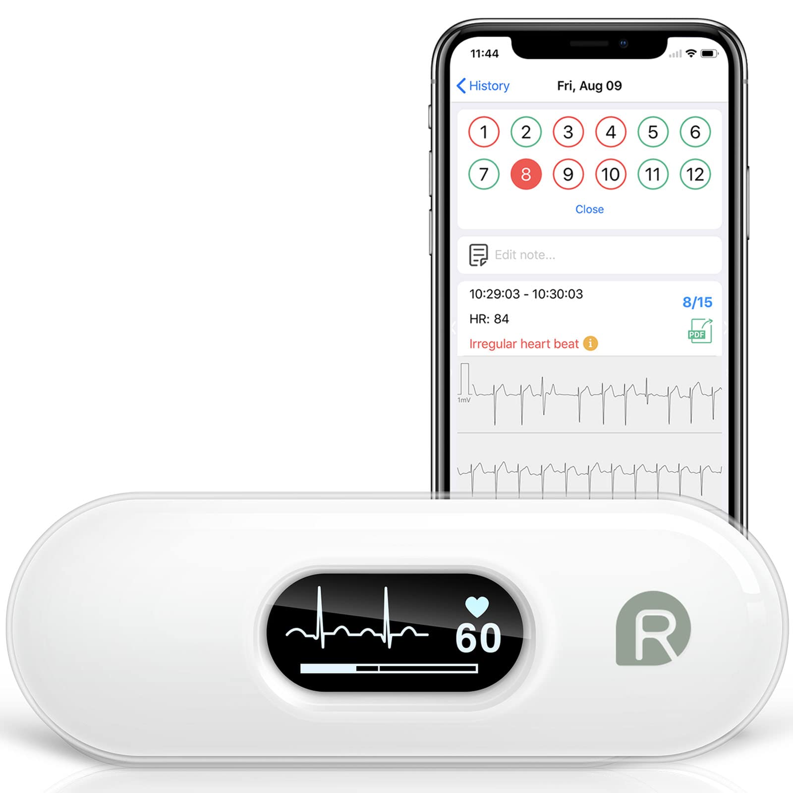 Wellue DUOEKS Personal EKG Monitor Used to Record ECG and Heart Rate