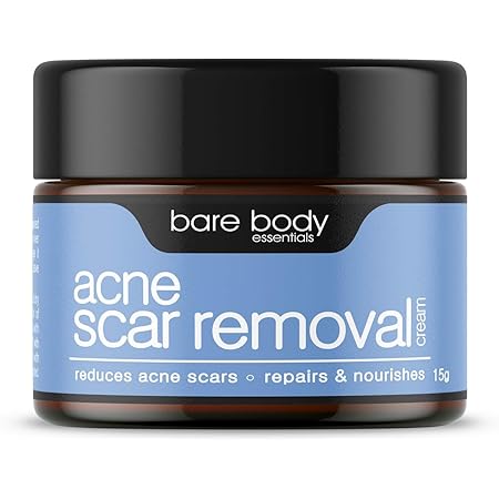 spot marks removal cream