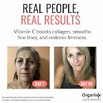 Organixx Restore Vitamin C Serum, Daily Face Serum With Hyaluronic Acid, Organic Vitamin E, Witch Hazel, Glycerin, & Aloe Vera, Brightening Formula, Gentle on Sensitive Skin, Vegan Skin Care, 1 FL Oz - Image 4