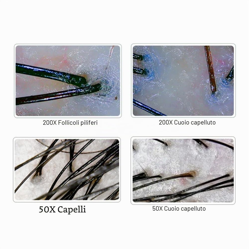 Microscopio dermatoscopico USB ad ultrasuoni ad alta risoluzione per diagnostica medica e cutanea, portatile e facile da usare, ideale per gli operatori sanitari