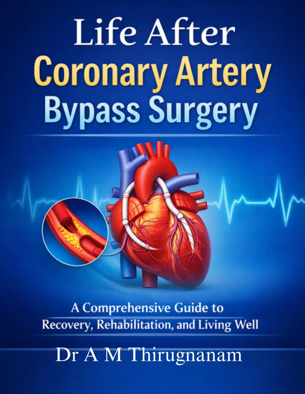 Life After Coronary Artery Bypass Surgery: A Comprehensive Guide to Recovery, Rehabilitation, and Living Well