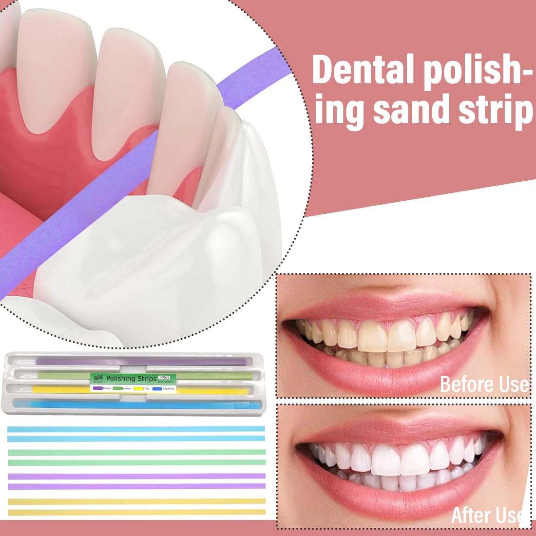60 Tiras de Pulido Dental, Herramienta de Lijado de Dientes, Pulidora Dental para Cuidado Bucal