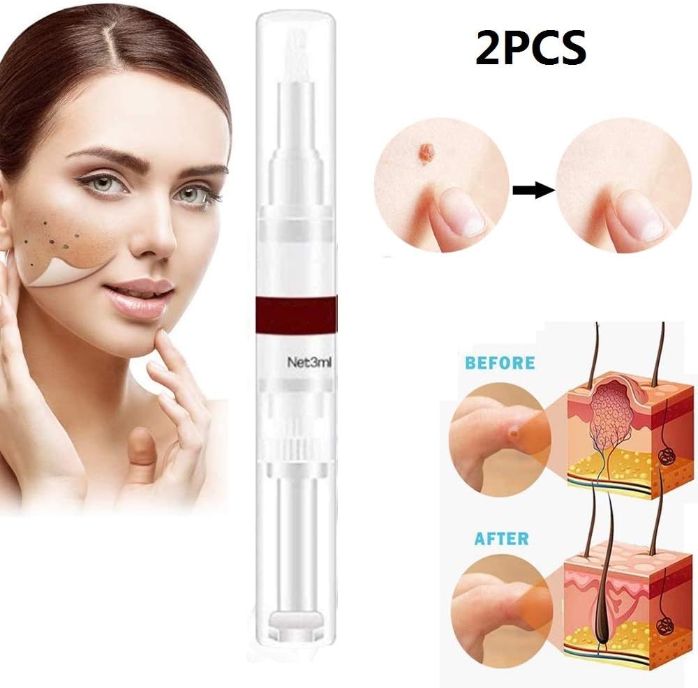 rimozione indolore delle verruche