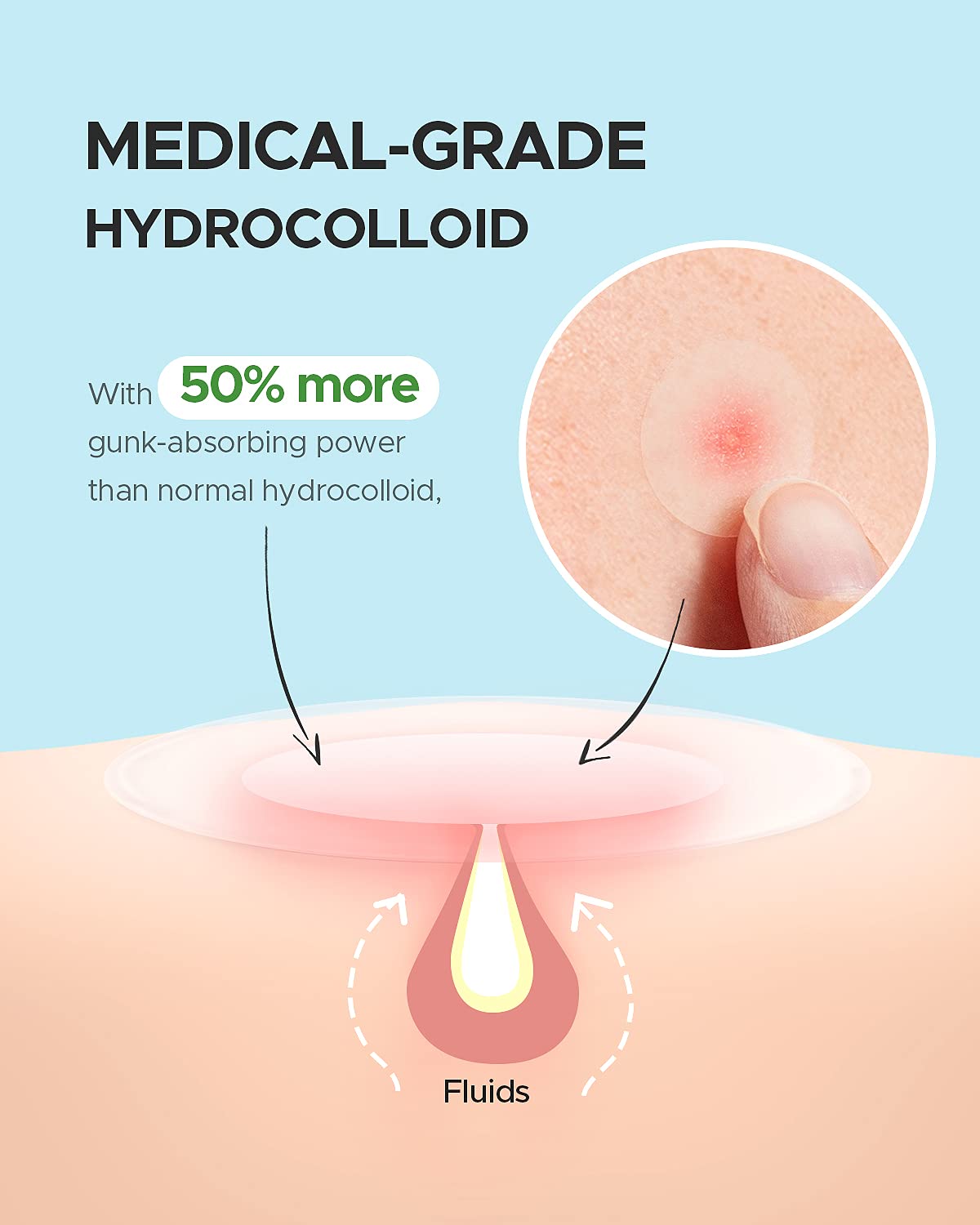 Acne Pimple Patch (180 Counts 4 Sizes), Invisible Hydrocolloid Acne Patch with Tea Tree Oil & Calendula Oil, Acne Spot Healing Patch Zit Patches for Face : Beauty & Personal Care